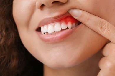 Gum Treatment in Greater Noida