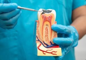 Best Root Canal Treatment in Greater Noida