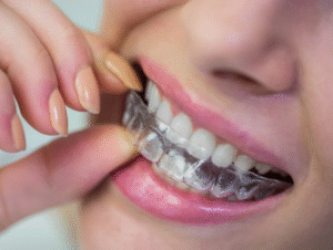 Best Dental Clinic for Invisible Braces in Greater Noida
