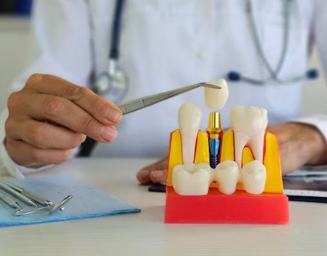Dentistry for Crowns and Bridges in Greater Noida
