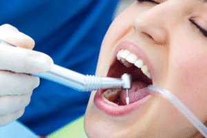 Dentist for Gum Treatment in Noida Extension