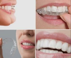Dental clinic for Aligners in Greater Noida