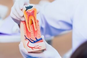 Root Canal Treatment in Noida Extension